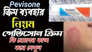 Pevisone Cream ointment Review [upl. by Alekahs]