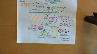 Cholesterol Metabolism Part 13 [upl. by Ahsimed]