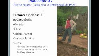 umh2658 201314 Lec51 Podoconiosis [upl. by Grefer]