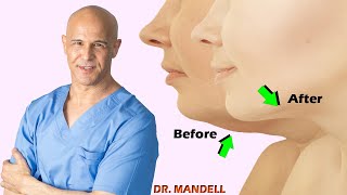 Simple Jawline Exercises to Remove Double Chin  Dr Alan Mandell DC [upl. by Calia]