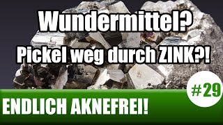 Wundermittel Pickel weg durch ZINK ENDLICH AKNEFREI 29 [upl. by Bridgette343]