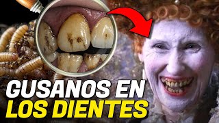 ¿POR QUÉ LOS DIENTES PODRIDOS ERAN TAN EXITOSOS EN EL PASADO [upl. by Wenoa]