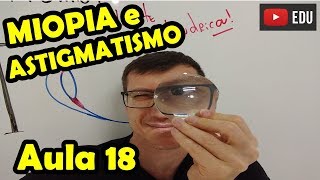 MIOPIA HIPERMETROPIA e ASTIGMATISMO  Óptica da VISÃO  Aula 18  Prof Boaro [upl. by Cuthbertson560]