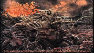 FULL ALBUM Postcoital Ulceration  Continuation of Defective Existence After Multiple [upl. by Aralc852]