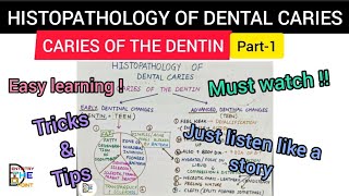 HISTOPATHOLOGY OF DENTAL CARIES  CARIES OF THE DENTIN PART1 [upl. by Oswal]