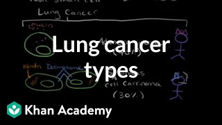 Lung cancer types  Respiratory system diseases  NCLEXRN  Khan Academy [upl. by Susejedairam]