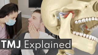 TMJ Explained  Jaw Pain Causes amp Symptoms [upl. by Martinelli913]