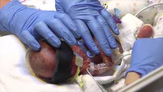 Inside our Neonatal Intensive Care Unit [upl. by Kris]