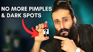 Simple Solution For Pimples Dark spots Pigmentation  Bearded Chokra [upl. by Nujra]