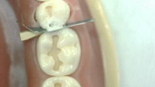 Cl II Cavity preparation Lower 2nd Premolar GV Black Dr Ahmed Sleibi [upl. by Ynoyrb]