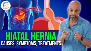 Understanding Hiatal Hernia causes symptoms diagnostic tests treatments [upl. by Guidotti42]