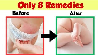 Curing Baby Diaper rashes is ActuallyEASY [upl. by Annahtur]