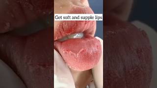 Chapped lips treatment get soft and supple lips short video 😱🔥👍 [upl. by Natek]