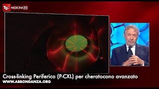 Intervento cheratocono avanzato PCXL  Dr Abbondanza al Tg2 [upl. by Denison]