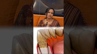 Reason behind shaking tooth  Dr Dhivya Darshani [upl. by Mundford631]