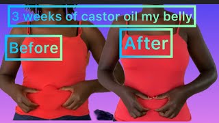 Castor oil to reduce belly fat results before and after [upl. by Alleuqram]