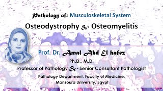 Osteodystrophy and Osteomyelitis lecture شرح محاضرة Bone diseases [upl. by Ellened458]