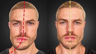 How to Fix Jaw amp Face Asymmetry FOREVER [upl. by Ursulette]