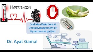 Dental management of hypertensive patients [upl. by Timothy]