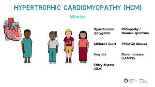 Hypertrophic Cardiomyopathy HCM Clinical Practice Update Whiteboard Video [upl. by Kciregor523]