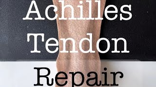 Felt Surgery 🔪🪡  Open Achilles Tendon Repair🦵🏼 [upl. by Nirre638]