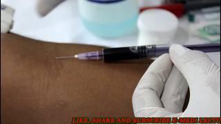 बल्ड कलेक्शन का आसान तरीका Blood collection technique Blood sample collection procedure [upl. by Ibocaj]