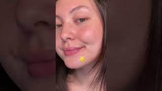 testing out the starface pimple patches [upl. by Enwad]