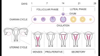 Amenorrhea  Definition Causes Signs and Symptoms Investigation and Management [upl. by Skricki80]