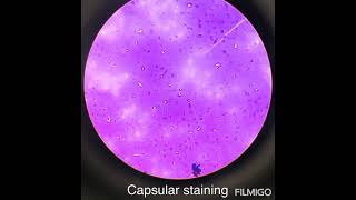 Bacillus capsular and spore staining [upl. by Basilius]