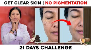 How to Treat Melasma at Home  21 Days skin care Challenge for Radiant Skin  Skin Care [upl. by Berstine]