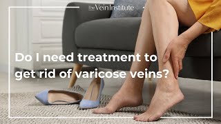 Treatment vs AtHome Care for Varicose Veins [upl. by Narmak]