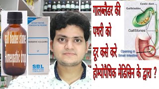 Gall bladder stone  Homeopathic medicine for Gall bladder stone  Explain [upl. by Castera]