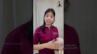 What is Pterygium  Dr Swetha Sajja  Buddhudu Hospital [upl. by Boycie]