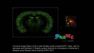 Amyloid beta plaquesthioflavinS analysis in Alzheimers disease using tissue clearing technology [upl. by Ailana]