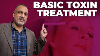 Basic Botox Toxin Injection for the Upper Face Forehead Frown Lines and Eyes  BTC Training [upl. by Acina]