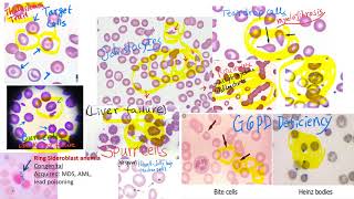 hematology in 10 min Peripheral blood smear examination under microscope [upl. by Gnet285]