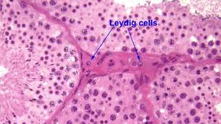 MAXIMIZE YOUR TESTOSTERONE  Leydig Cells [upl. by Georgia]