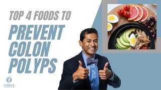 Foods that prevent polyps colon edition [upl. by Annoya124]