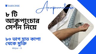 ৮ সেশন আকুপাংচারে ৮০ ভাগ পার্কিনসন্স রোগ থেকে মুক্তি [upl. by Phemia]