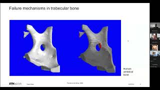 Multiscale Bone Biomechanics and Imaging [upl. by Ireva]