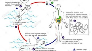 Dracunculus medinensis Guinea worm شرح دودة غينيا المسببة لداء التنينات لدكتورة نرمين خاليد [upl. by Charo]