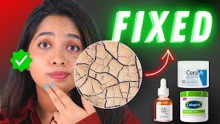 How To Fix Dry Skin in 3 Simple Steps [upl. by Eudosia650]