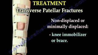 Patellar Fractures  Everything You Need To Know  Dr Nabil Ebraheim [upl. by Pigeon119]