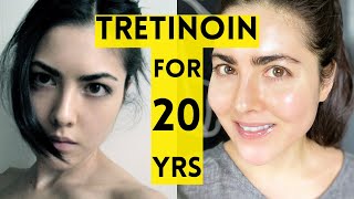 20 Year Results of Using Tretinoin [upl. by Trow]