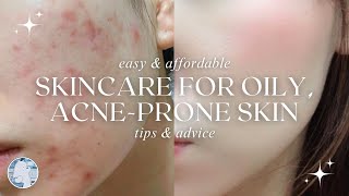 skincare for ✨OILY amp ACNEPRONE SKIN ✨  affordable DIYs and tips  aesthetic guide  ♡ berryrena [upl. by Gaudette]