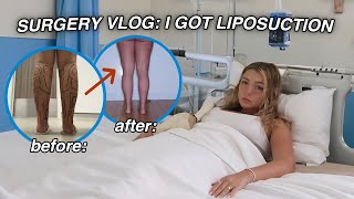 SURGERY VLOG I GOT LIPOSUCTION it was hell [upl. by Madelena133]