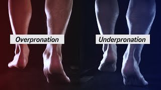 How to Determine your Pronation [upl. by Odranar]