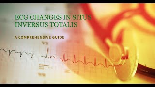 Deciphering ECG Patterns in Situs Inversus Totalis A Cardiological Analysis [upl. by Ariada]