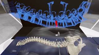 VR Simulator  Spinal Cord Surgery with B Braun Aesculap [upl. by Saraiya284]