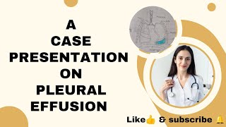 case presentation on pleural Effusion pleuraleffusion casepresentation subscribe nursingstudent [upl. by Aerdnaid254]